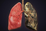 Akciğerleri 3 günde sigara dumanından arındırın!